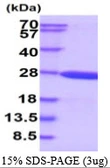 Human Beta crystallin S protein, His tag. GTX67326-pro