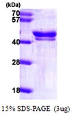 Human ICAD protein, His tag. GTX67354-pro
