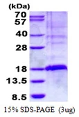 Human GILZ protein, His tag. GTX67362-pro