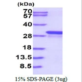 Human GSTT1 protein, His tag. GTX67442-pro