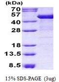 Human Cytokeratin 19 protein, His tag. GTX67516-pro