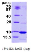 Human PDE6D protein, His tag. GTX67620-pro
