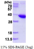 Human PPA1 protein, His tag. GTX67658-pro