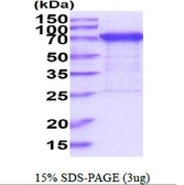 Human PPM1G protein, His tag. GTX67659-pro