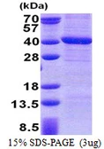 Human PPP4C protein, His tag. GTX67665-pro