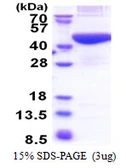 Human PRPSAP2 protein, His tag. GTX67687-pro