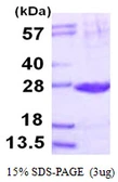 Human PSMB2 protein, His tag. GTX67696-pro