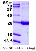 Human RBP1 protein, His tag. GTX67743-pro