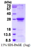 Human RGS1 protein, His tag. GTX67746-pro
