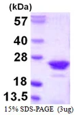 Human RGS10 protein, His tag. GTX67749-pro