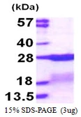 Human RPS7 protein, His tag. GTX67776-pro