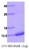 Human S100A4 protein, His tag. GTX67789-pro