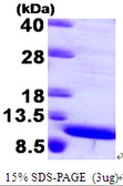 Human S100A8 protein. GTX67793-pro