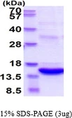 Human S100A8 protein, His and Myc tag. GTX67794-pro