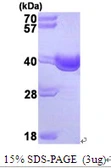 Human SGTA protein, His tag. GTX67814-pro