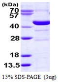 Human Spermine synthase protein, His tag. GTX67823-pro