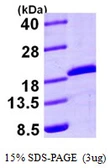 Human UBE2A protein, His tag. GTX67913-pro