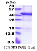 Human USF1 protein, His tag. GTX67935-pro