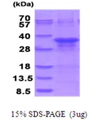 Human ZFAND5 protein, His tag. GTX67950-pro