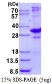 Human CRSP9 protein, His tag. GTX68057-pro