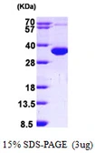 Human CCS protein, His tag. GTX68099-pro