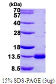 Human DNAL4 protein, His tag. GTX68120-pro