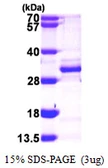 Human BCAS2 protein, His tag. GTX68136-pro