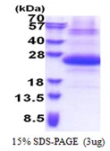 Human SSSCA1 protein, His tag. GTX68165-pro