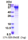 Human DCTN2 protein, His tag. GTX68172-pro