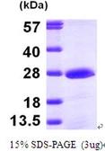 Human PMVK protein, His tag. GTX68186-pro