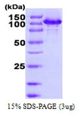 Human HSP105 protein, His tag. GTX68194-pro
