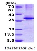 Human CPSF4 protein, His tag. GTX68197-pro