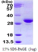 Human RAB32 protein, His tag. GTX68213-pro