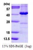 Human MAPRE2 protein, His tag. GTX68214-pro