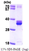 Human NUDT5 protein, His tag. GTX68231-pro