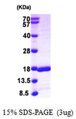 Human GABARAPL2 protein, His tag. GTX68253-pro
