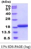 Mouse gamma Synuclein protein, His tag. GTX68292-pro