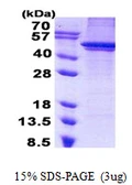 Human ARC protein, His tag. GTX68320-pro