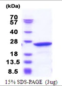 Human NCS1 protein, His tag. GTX68323-pro