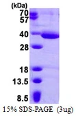 Human HAAO protein, His tag. GTX68330-pro