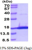 Human SNAPIN protein, His tag. GTX68333-pro