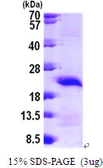 Human CRHSP-24 protein, His tag. GTX68340-pro