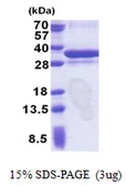 Human ORC6 protein, His tag. GTX68341-pro