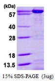 Human AK5 protein, His tag. GTX68379-pro