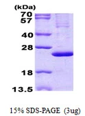 Human MRPL13 protein, His tag. GTX68424-pro