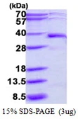 Human DERA protein, His tag. GTX68469-pro