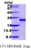 Human UFC1 protein, His tag. GTX68512-pro