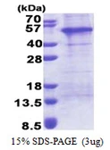 Human AP1AR protein, His tag. GTX68594-pro