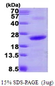Human NHP2 protein, His tag. GTX68603-pro