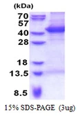 Human MAP1 protein, His tag. GTX68690-pro